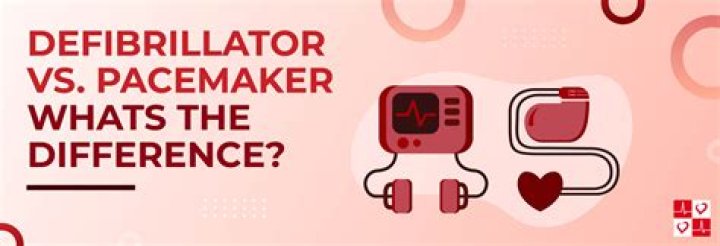 What is mode of pacemaker?