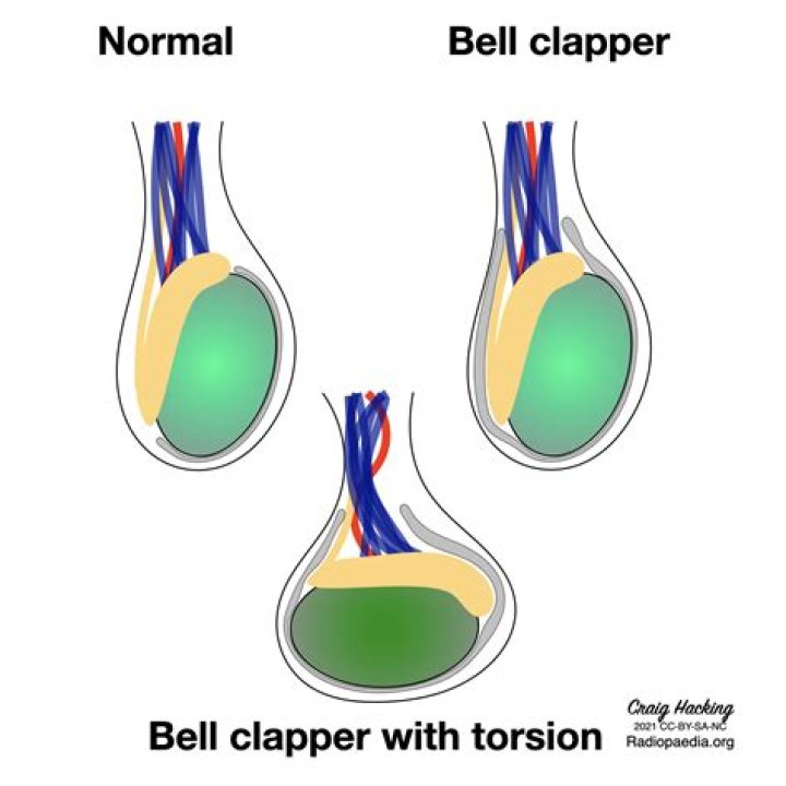 What is the clapper in a bell called