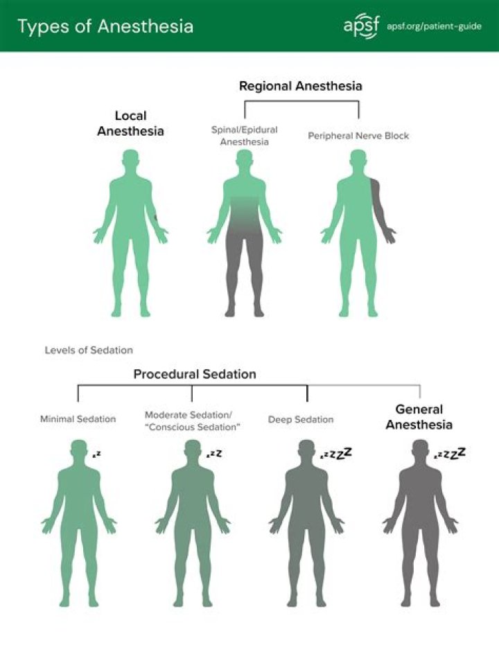 What is the difference between general anesthesia and regional anesthesia?
