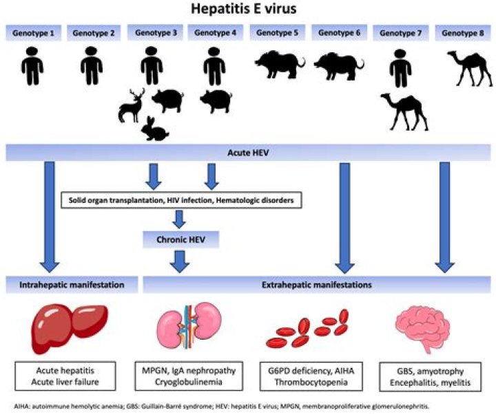What is the epidemiology of hepatitis