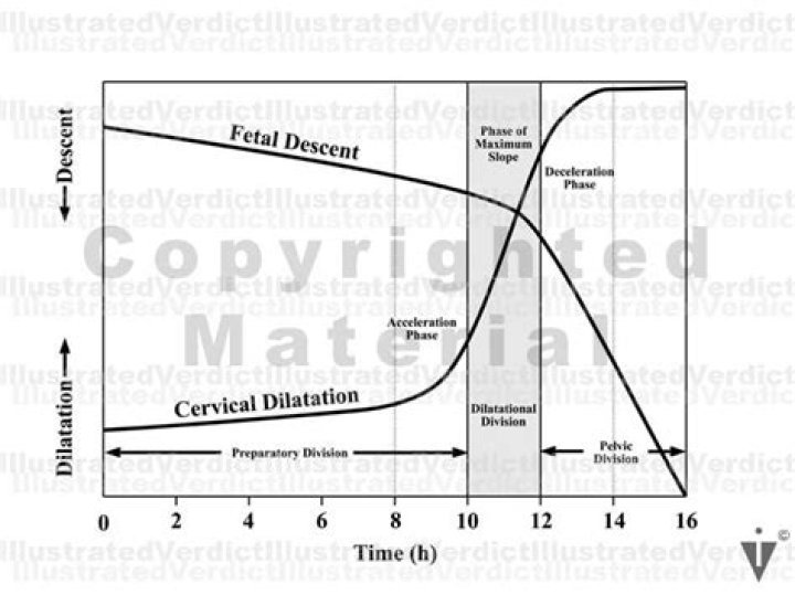 What is the labor curve?