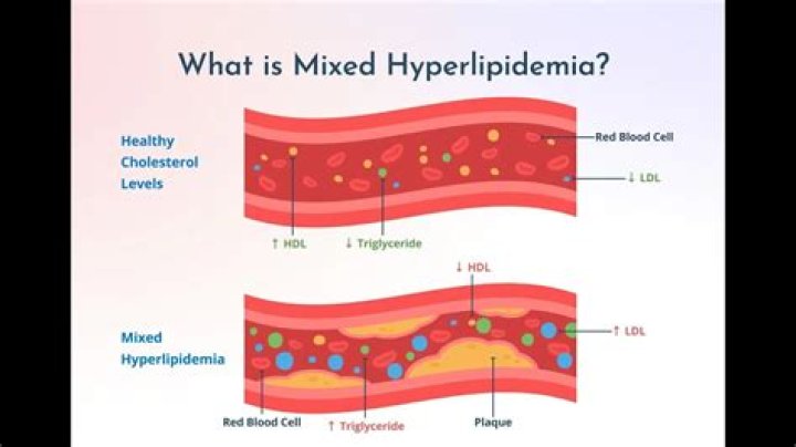 What is the lipemia index?