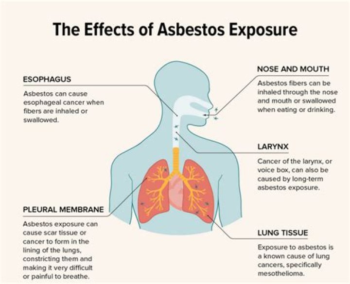 What is the most common symptom of asbestosis?