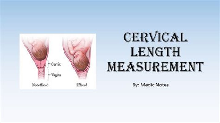 What is the normal cervical length for normal delivery?