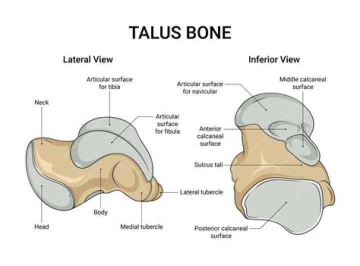 What is the Talis assessment?