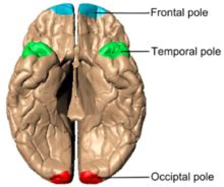 What is the temporal pole of the brain?