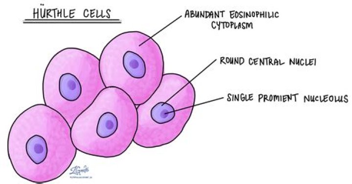What percentage of Hurthle cell neoplasms are malignant?