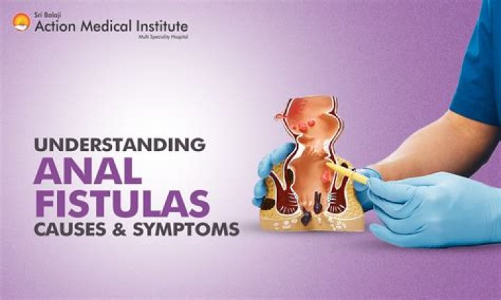 What problems can a fistula cause?