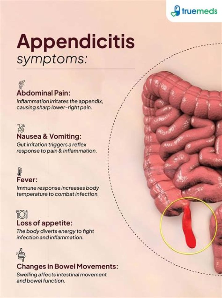 What were your first signs of appendicitis?