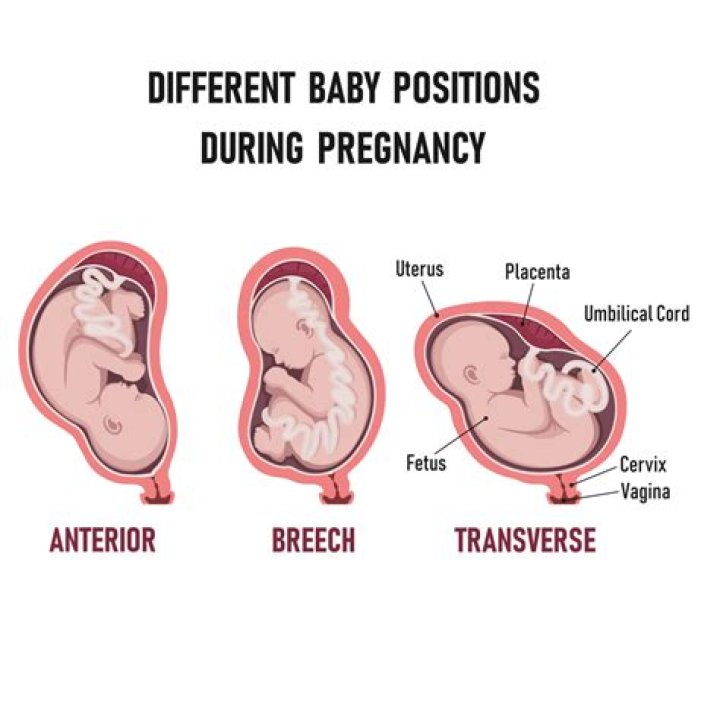Where do you feel kicks if baby is transverse?