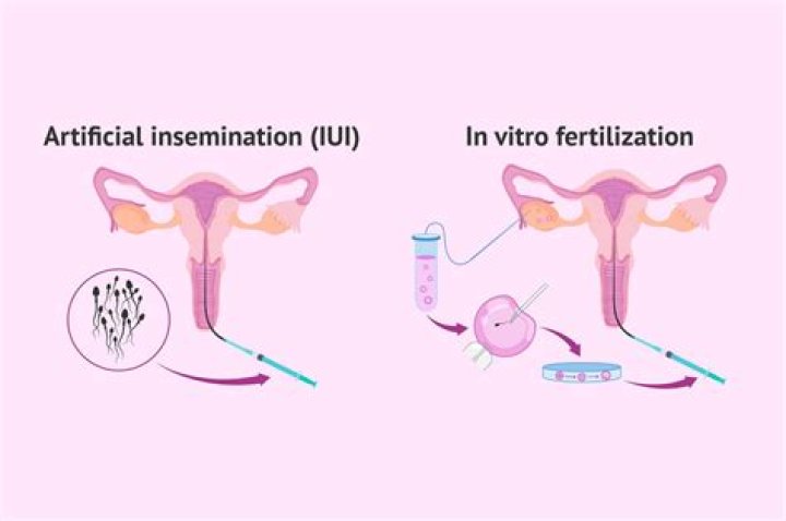 Where is artificial insemination used?