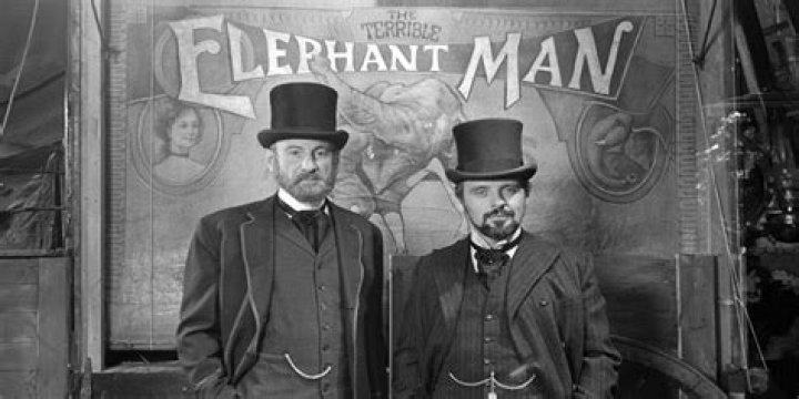 Where was the elephant man born