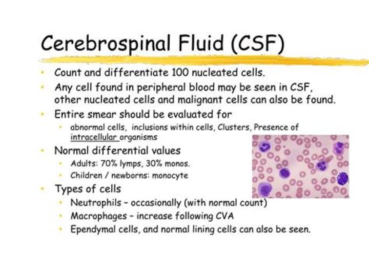 Which cells can be seen in CSF fluid?