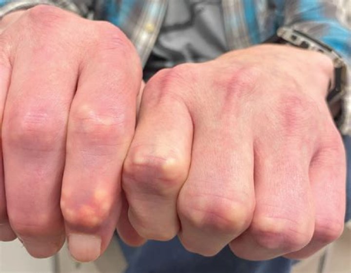 Why does it look like I have white paint on my hands?