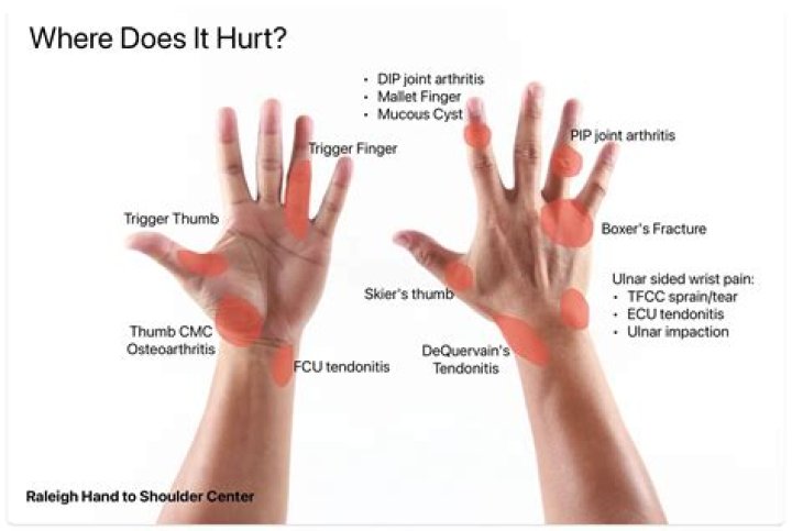 Why does my thumb knuckle joint hurt?