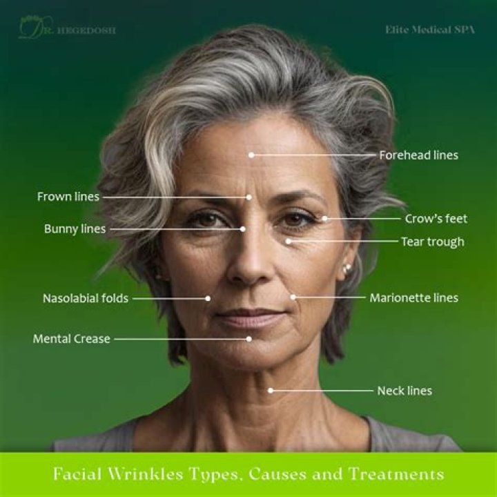 Why is my sausage wrinkled?